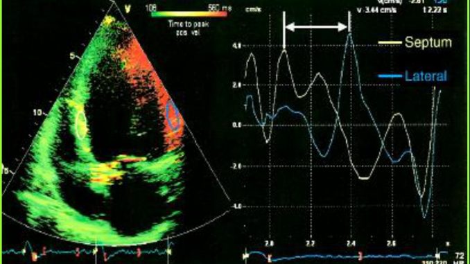 TISSUE SYNCHRONIZATION IMAGING