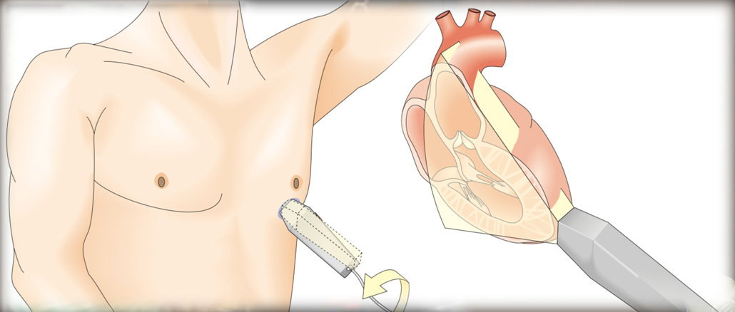 Pocket Atlas of Echocardiography – Atlas siêu âm tim dành cho người bắt đầu