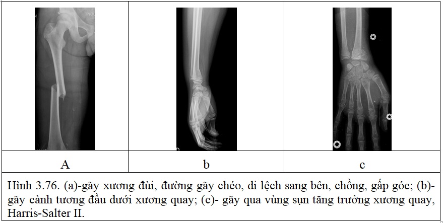 Bộ Y Tế Chẩn đoan Hinh ảnh Bộ May Vận động Virad