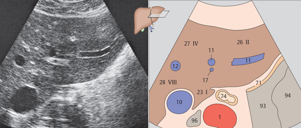 [PDF] Color Atlas of Ultrasound Anatomy – Thieme 2004