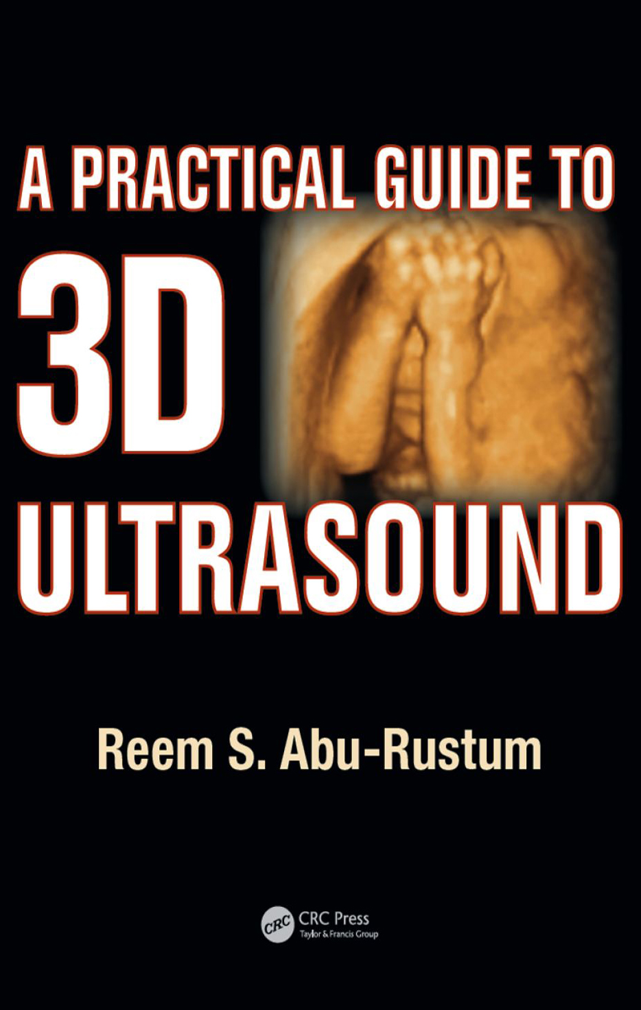 [PDF] A practical Guide to 3D ultrasound