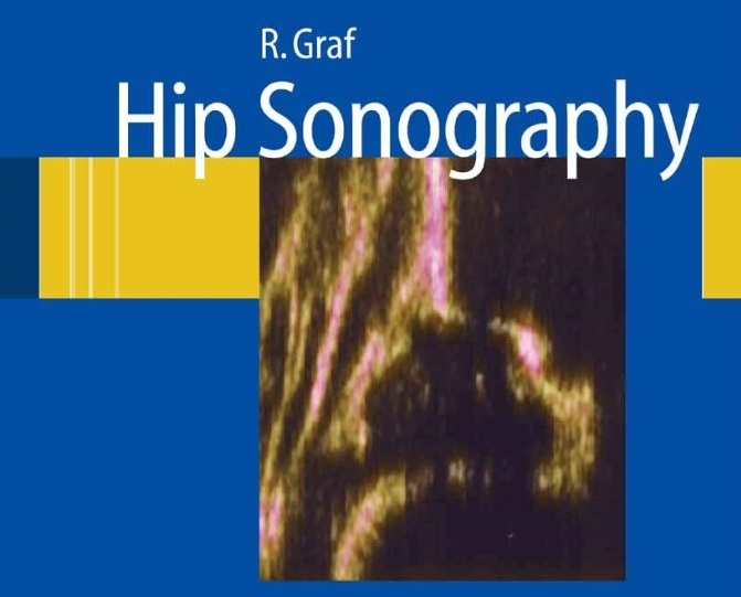Hip Sonography – Diagnosis and Management of Infant Hip Dysplasia