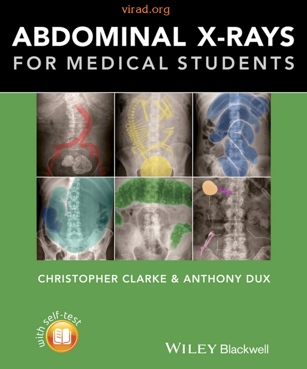 [FREE] Abdominal  X-raysfor Medical Students
