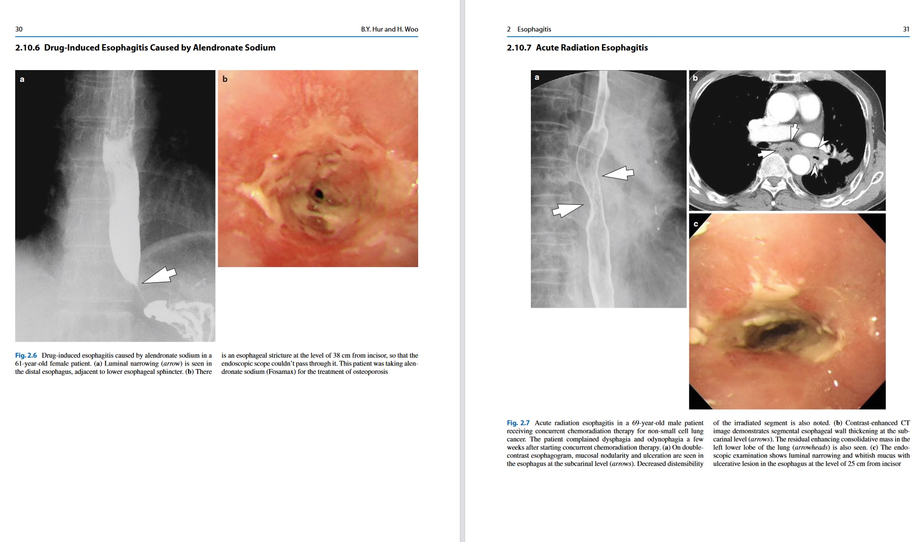 Radiology Illustrated - Gastrointestinal Tract