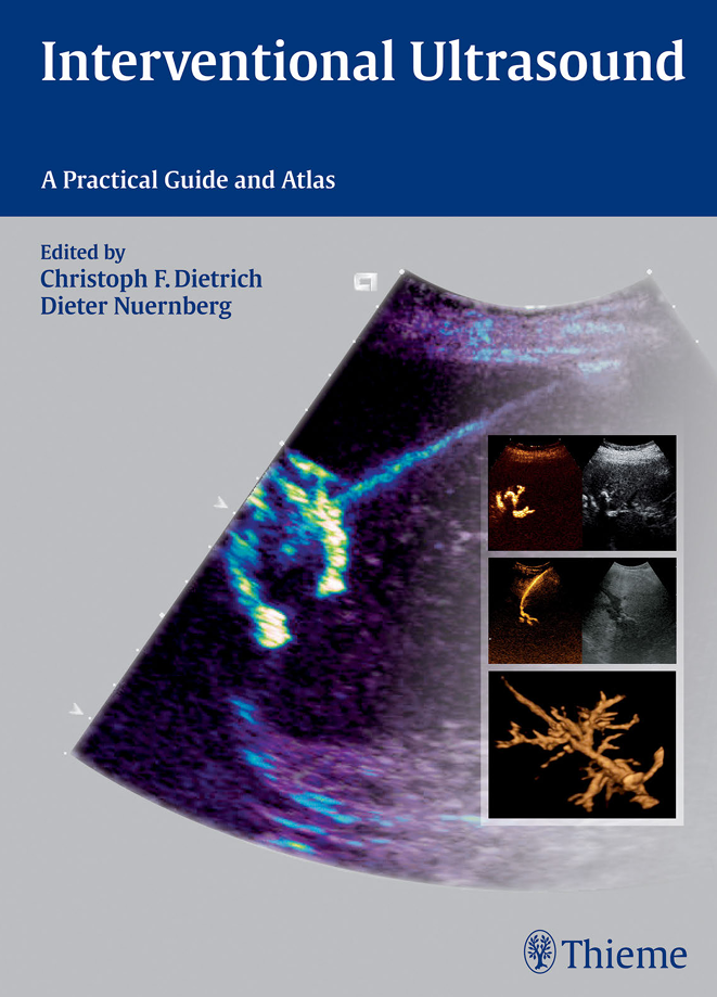 Sách siêu âm can thiệp: Interventional Ultrasound – a practical guide and Atlas